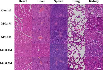 Small-Molecule Bi-DOTA Complex for High-Performance CT and Spectral CT Bioimaging